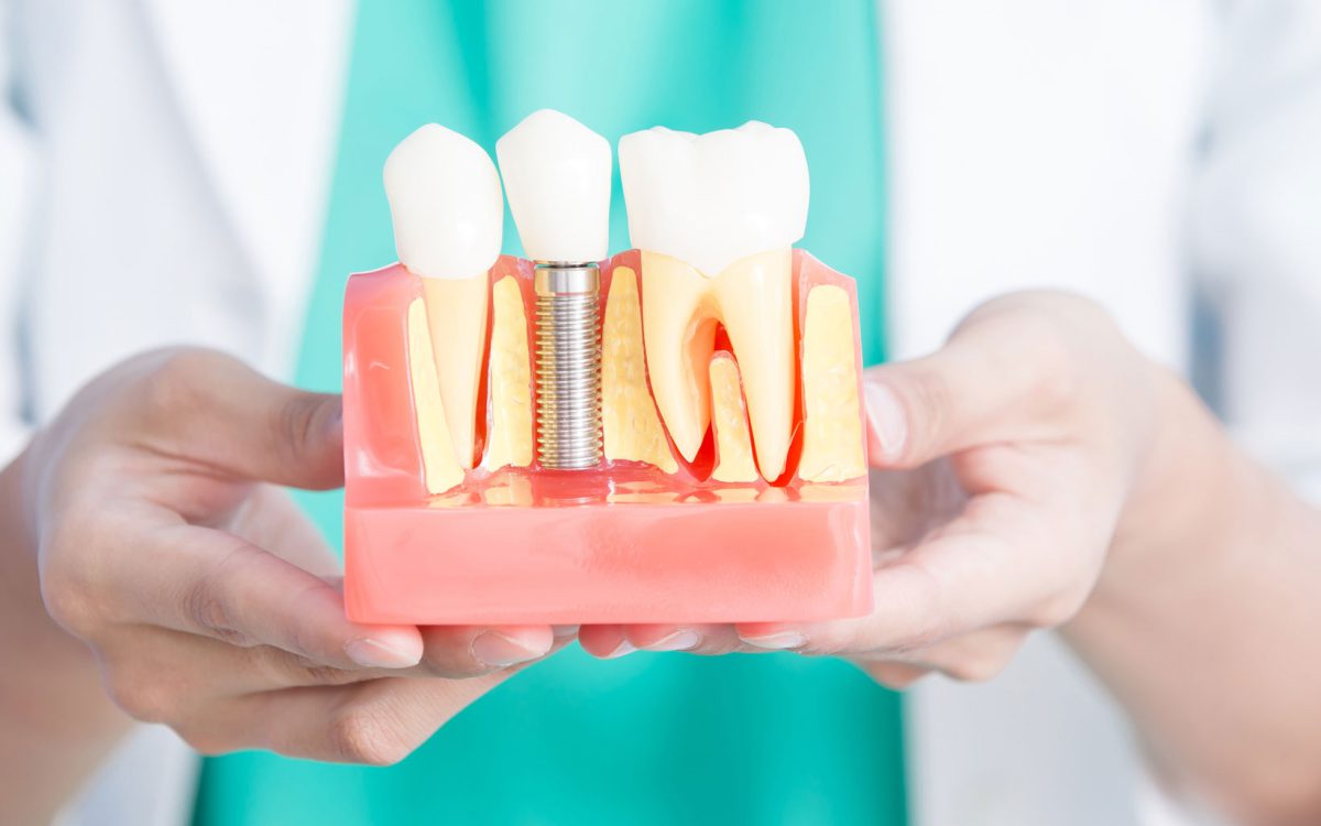 Dental implant courses